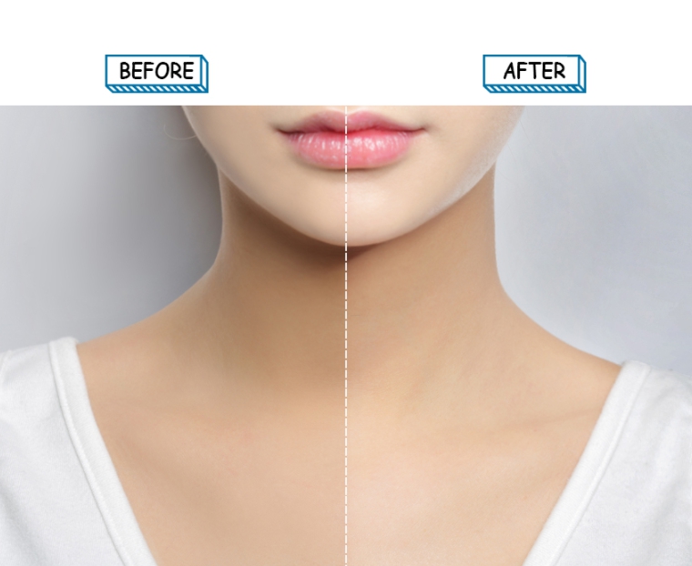 惊人,但是不死白,而是自然修饰肤色,像是很多女生都有脸,脖子色差问题